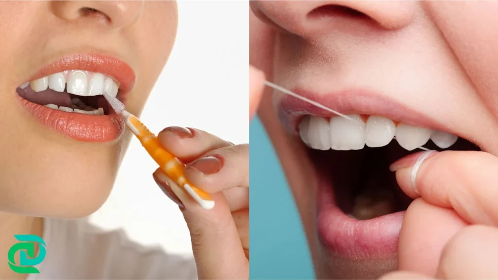 Comparing Interdental Brushes with Other Dental Tools