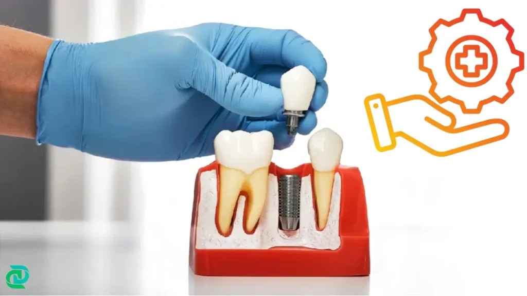 Dental Implants Maintenance and Care