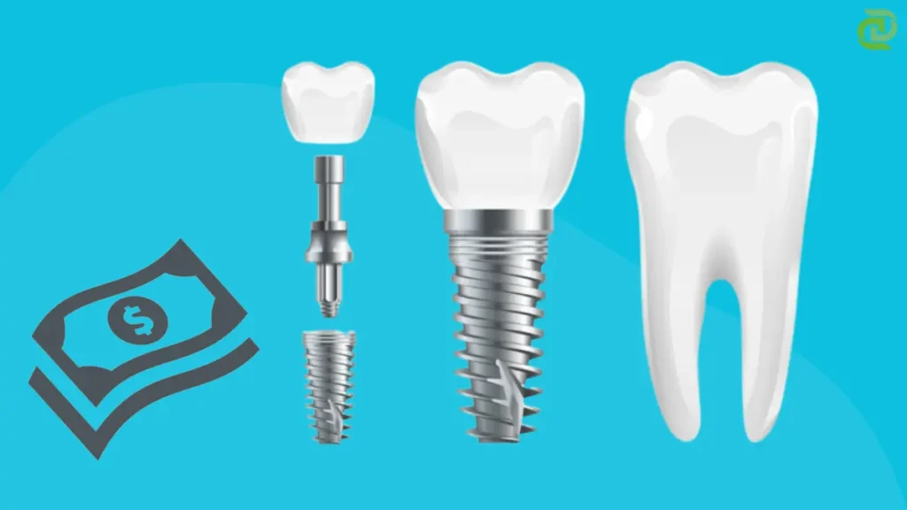 dental implants price