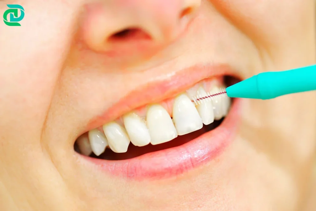 How to Properly Use Interdental Brushes