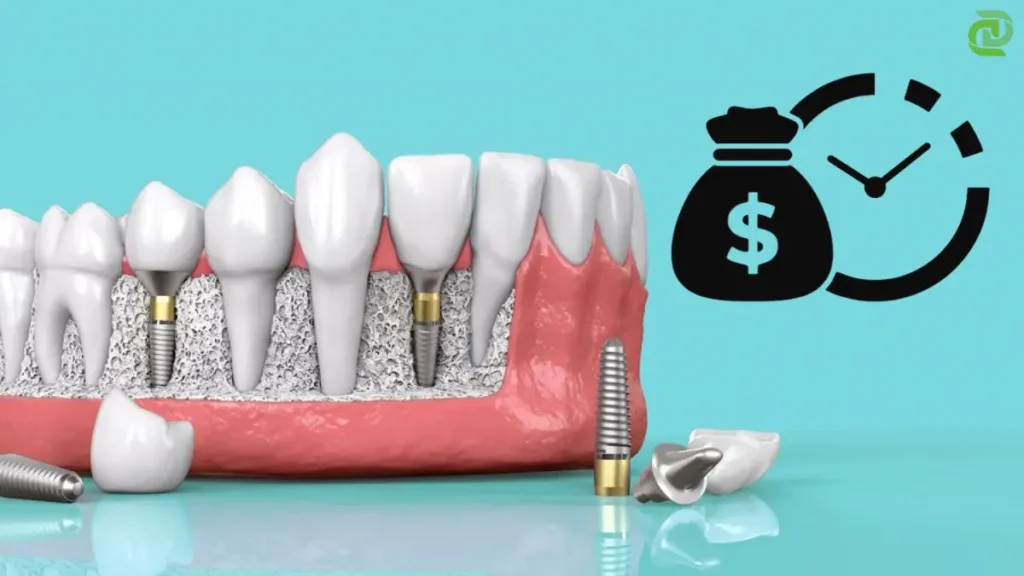 Longevity of Dental Implants