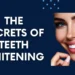 Teeth Whitening Secrets Revealing: Step-By-Step Guide