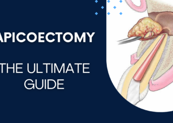 Apicoectomy