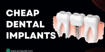 Cheap Dental Implants