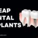 Cheap Dental Implants