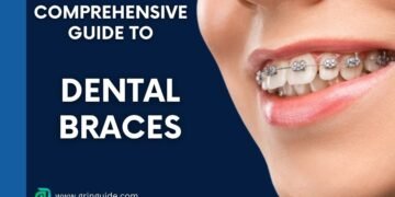 Dental Braces