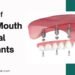 Cost of Full Mouth Dental Implants