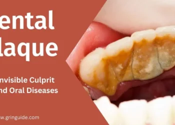 Dental Plaque the Invisible Culprit Behind Oral Diseases