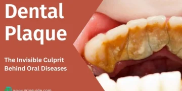 Dental Plaque the Invisible Culprit Behind Oral Diseases