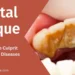 Dental Plaque the Invisible Culprit Behind Oral Diseases