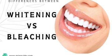 Differences Between Teeth Whitening and Bleaching Treatments