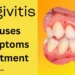 Understanding Gingivitis: Causes, Symptoms, and Treatment