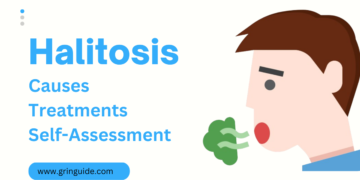 Understanding Halitosis: Causes, Treatments, and Self-Assessment 9 Understanding Halitosis