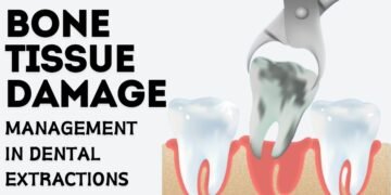 Management of Bone Tissue Damage in Dental Extractions