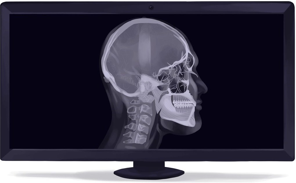 cephalometric X-rays