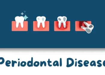 Periodontal Disease