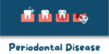 Periodontal Disease