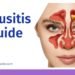 Sinusitis