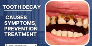 tooth decay