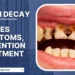 tooth decay