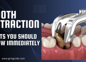 Tooth Extraction Facts you should know immediately