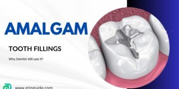 Amalgam Tooth Fillings