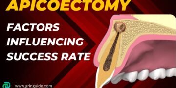 Apicoectomy Success Rate