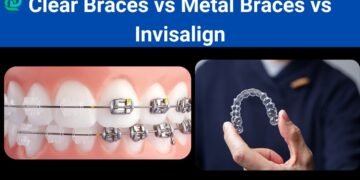 Clear Braces vs Metal Braces vs Invisalign to correct malocclusion