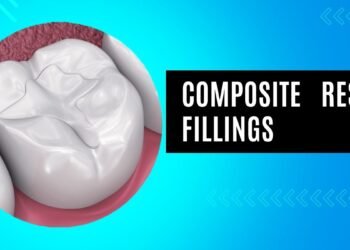 Composite Resin Fillings