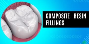 Composite Resin Fillings