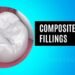 Composite Resin Fillings