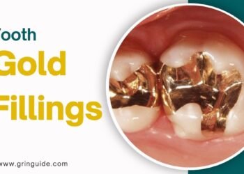 Gold Fillings Pros Cons Value and Cost