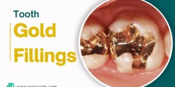 Gold Fillings Pros Cons Value and Cost