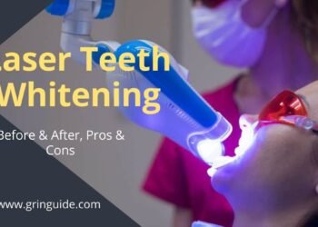 Laser Teeth Whitening