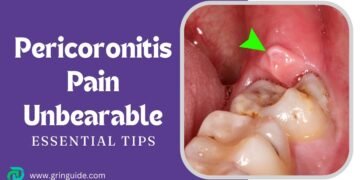 Pericoronitis Pain Unbearable