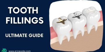 Tooth Fillings Guide