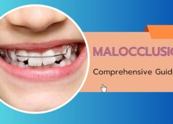 Malocclusion