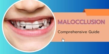 Malocclusion