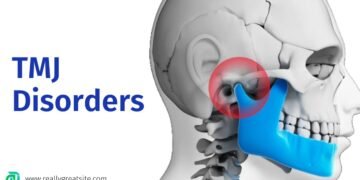 TMJ disorders Guide