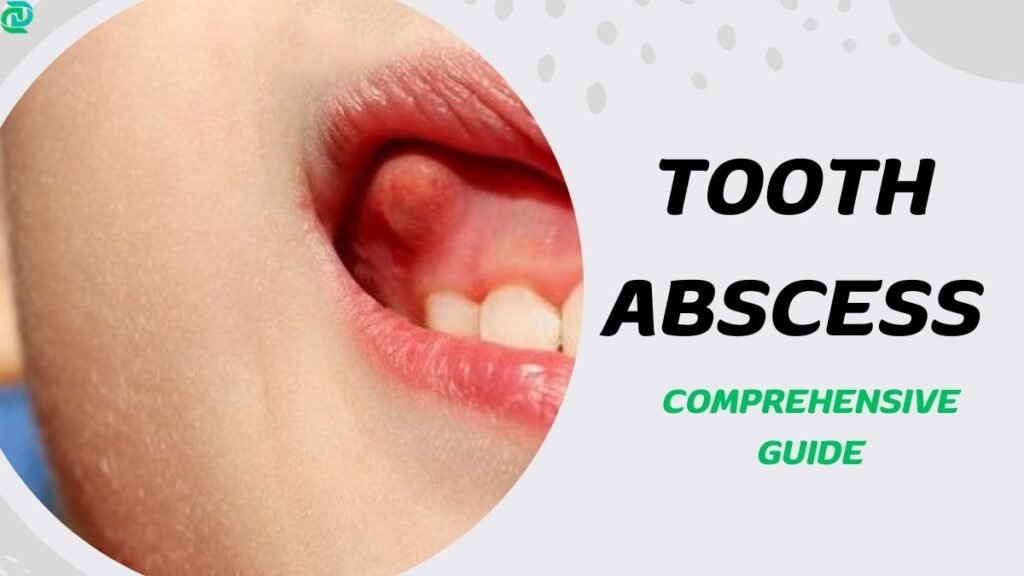 Tooth Abscess leads to tooth and jaw pain