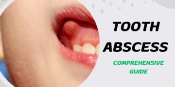 Tooth Abscess leads to tooth and jaw pain