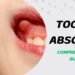 Tooth Abscess leads to tooth and jaw pain